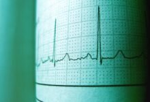 trace call for 9196662230