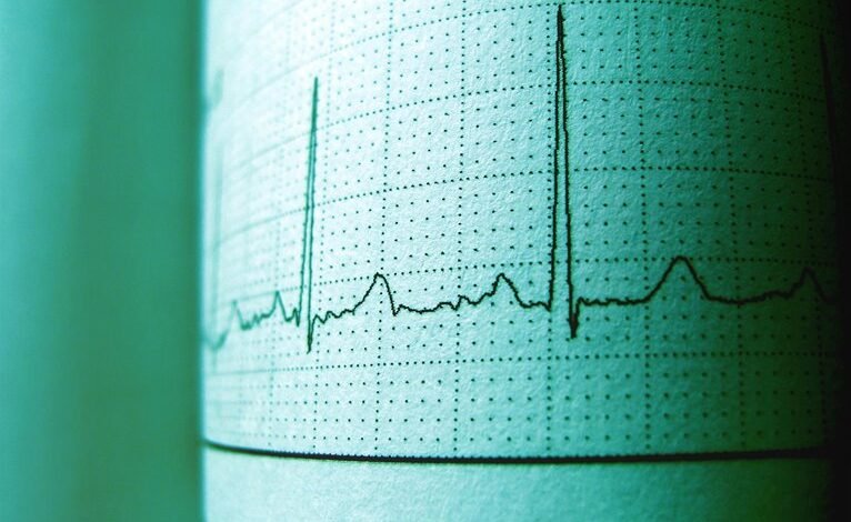 trace call for 9196662230